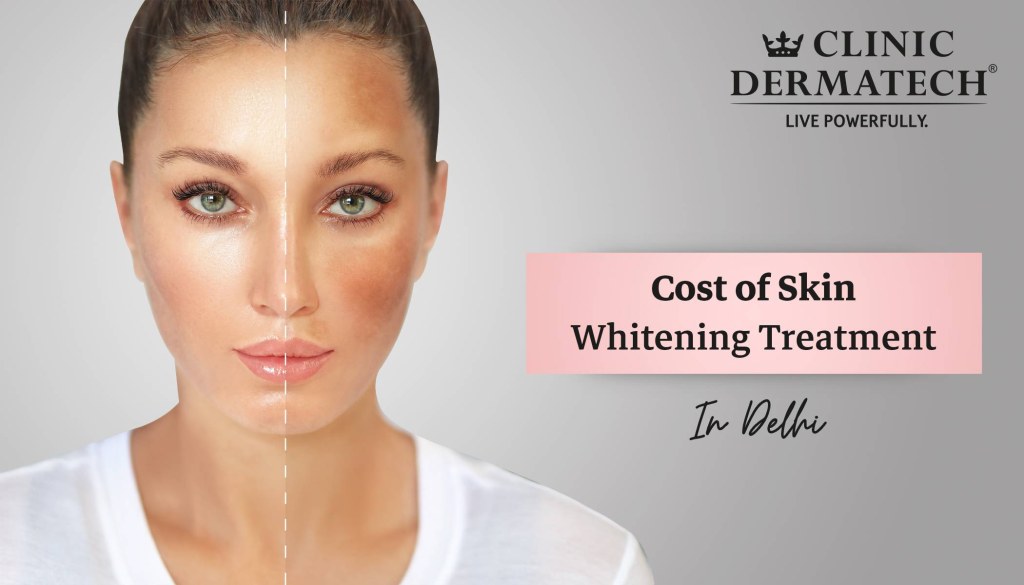 Picture of: Cost of Skin Whitening Treatment in Delhi – Clinic Dermatech