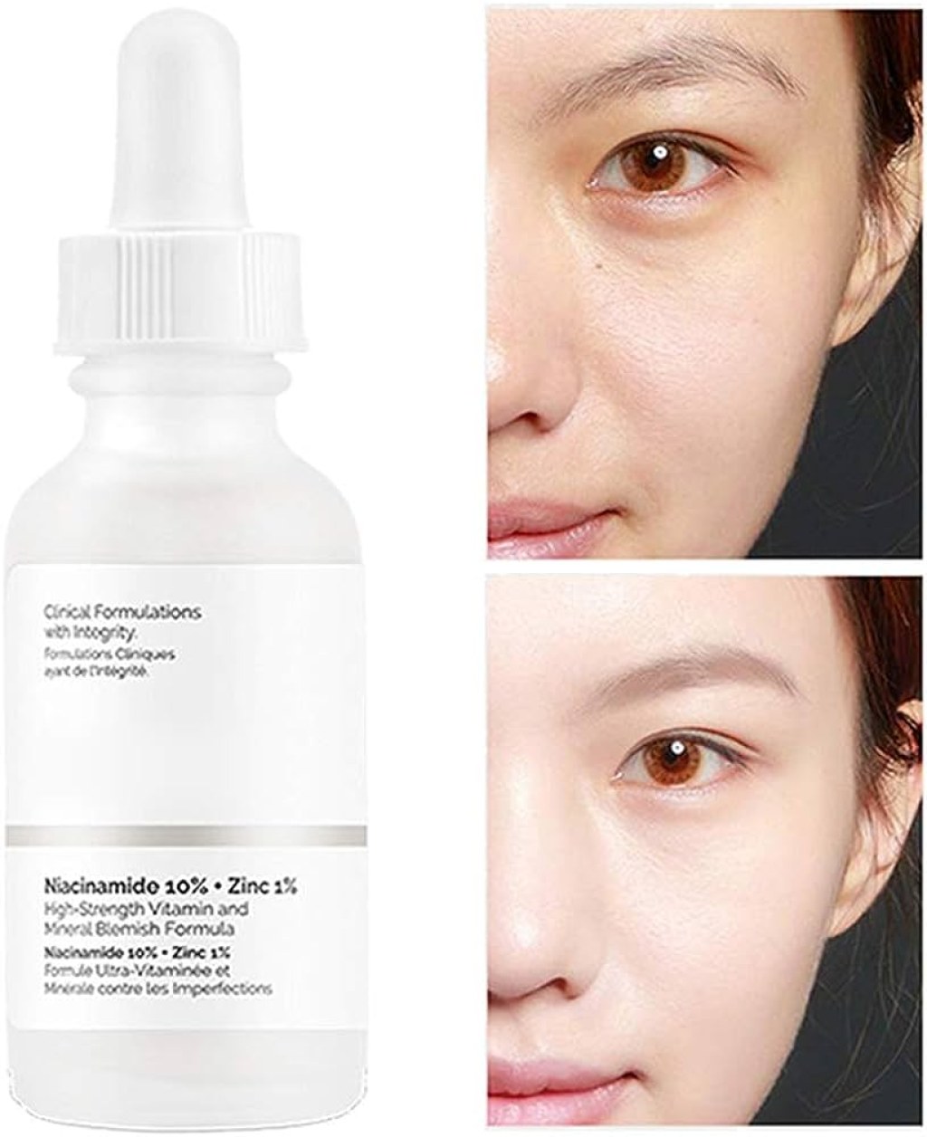 Picture of: Face Serum, % Niacinamide + % Zinc Cleansing Whitening