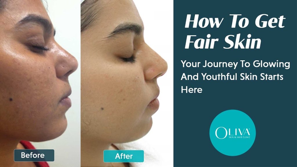 Picture of: Fair Skin Secrets Revealed – Myths, Facts, And Treatment Options