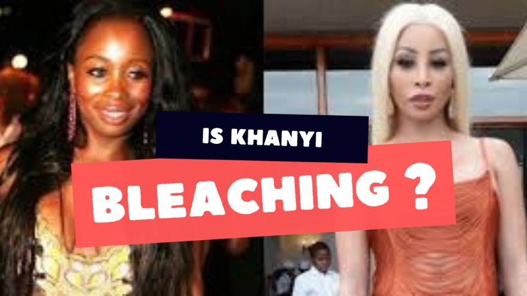 Picture of: Is YOUNG , FAMOUS, AND AFRICAN KHANYI SKIN BLEACHING ?