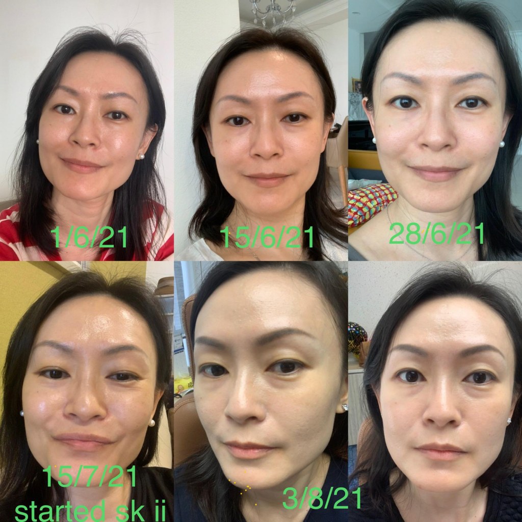 Picture of: My Journey of Anti Ageing for the past  months! : r/AsianBeauty
