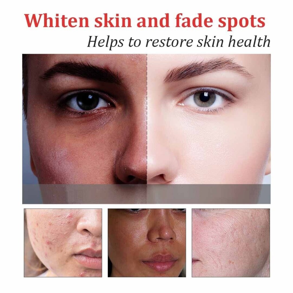 Picture of: Skin Whitening and Spots Fading Tea Pure natural Plant Extracts
