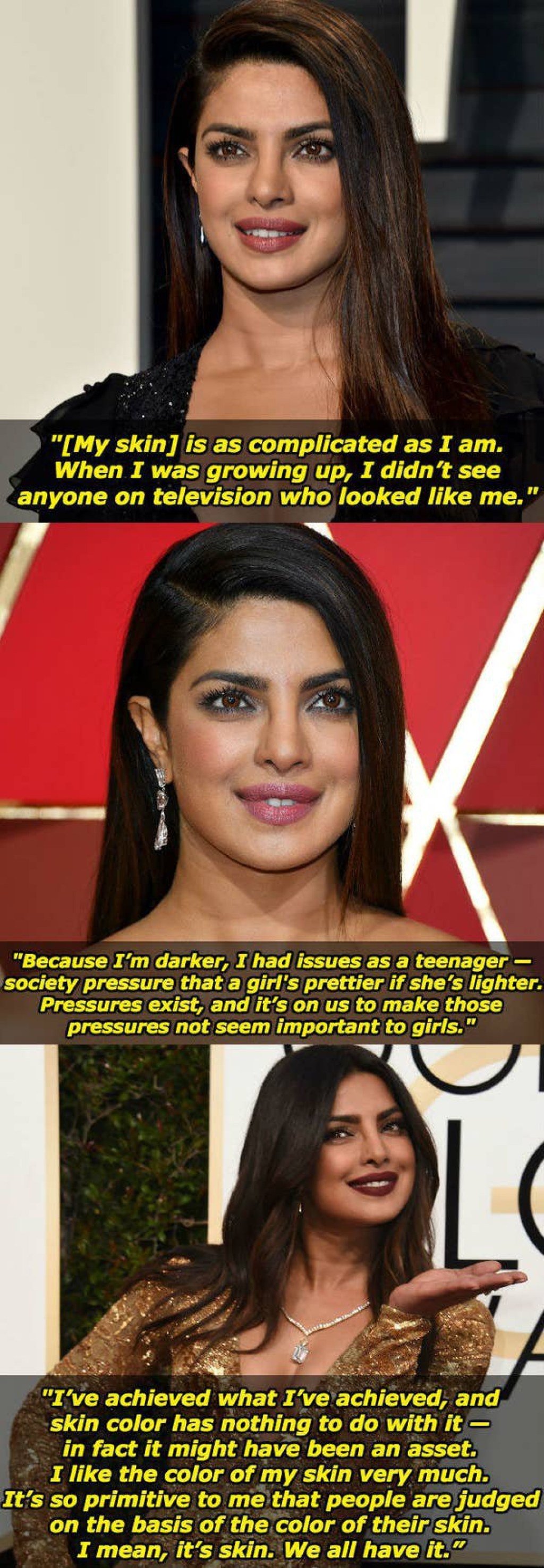 Picture of: Why is Priyanka Chopra’s skin darker than other Bollywood